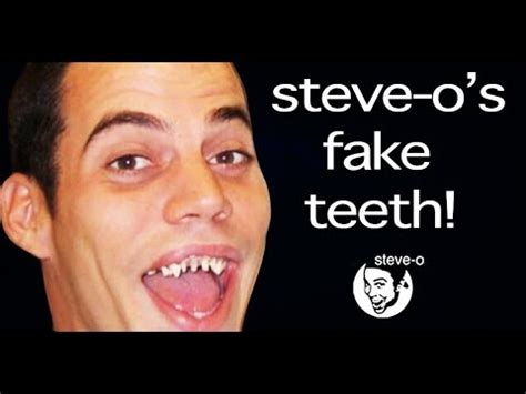are steve o teeth fake